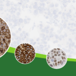 HistoCyte – ER/PR/HER2/PDL1 controls