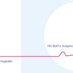 Sebia – Newborn haemoglobin disorders screening